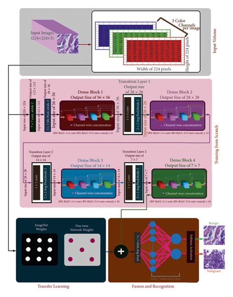 Classification Of Breast Cancer Histopathological Images Using Densenet