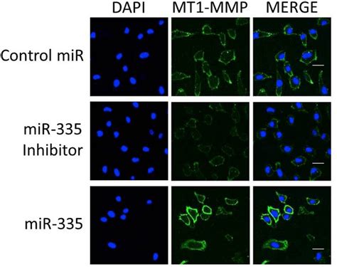 The Effect Of Mir 335 On Cell Surface Localization Of Mt1 Mmp As