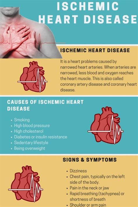 Ischemic heart disease – Artofit