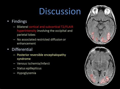 #PRESS | Anatomy bones, Mri brain, Radiology