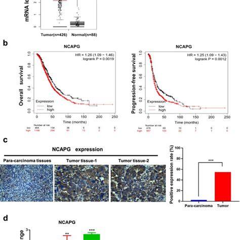 Ncapg Expression In Oc Tissues And Cell Lines A Ncapg Mrna Expression