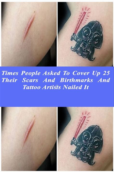 25 Times People Asked To Cover Up Their Scars And Birthmarks And Tattoo