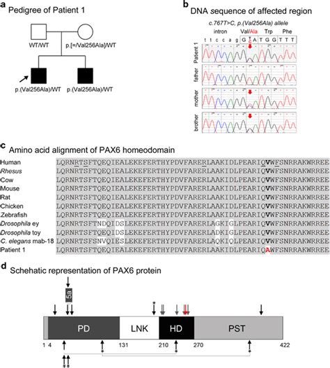 Pax6 Pathogenic Variant A Pedigree Of Patient 1 Patient 1 Proband