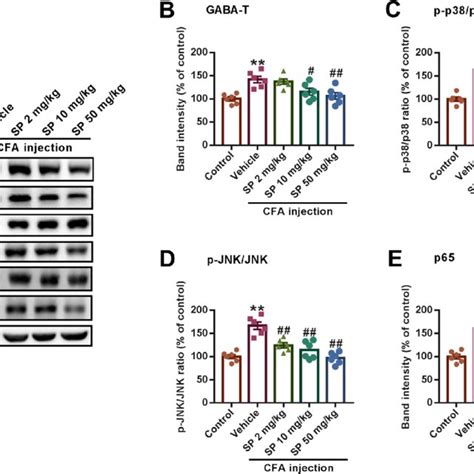 Sp Suppressed Pro Inflammatory Cytokine Levels In The Serum And Bla Of