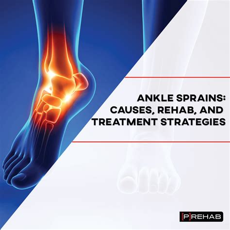 Ankle Sprains Causes Rehab And Treatment Strategies [𝗣]𝗥𝗲𝗵𝗮𝗯