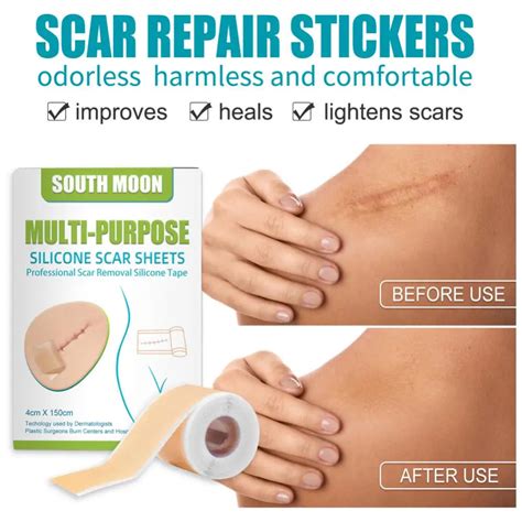 Silicone Scar Patch Long Lasting Popular Gentle Invisible Scar Solution Dermatologist