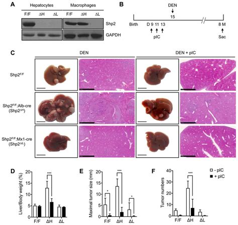 Pic Potently Inhibits Den Induced Hcc Independent Of Cell Type Specific