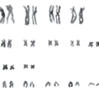 Karyotype Of Male M Arvalis F Obscurus Heterozygous For Chromosomal