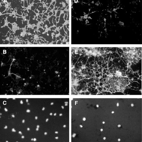 Immunostaining Of Oligodendrocyte Progenitors And 12 Day Differentiated