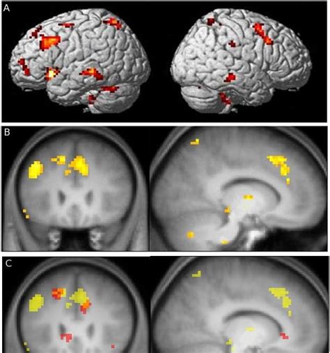 Regions involved in prosody for complex emotion. Brain regions showing ...