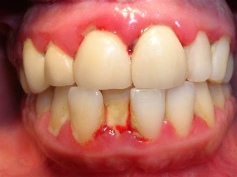 What Do You Know About Periodontal Disease