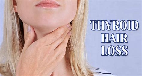 The Fundamentals Of Thyroid Hair Loss Revealed Lewigs