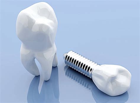 dental implants dr james van den berg