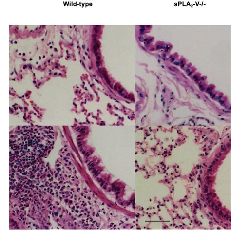 Impaired Chronic Allergen Induced Airway Goblet Cell Metaplasia In Spla