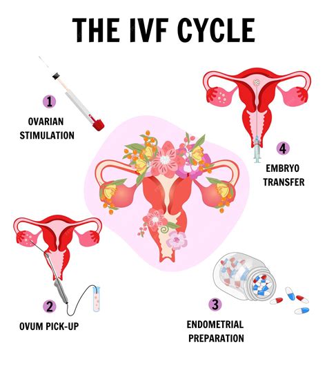 O Infográfico Do Ciclo De Fertilização In Vitro Em Vetor Vetor Premium