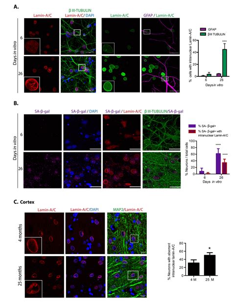 Cortical Neurons Develop A Senescence Like Phenotype Promoted By