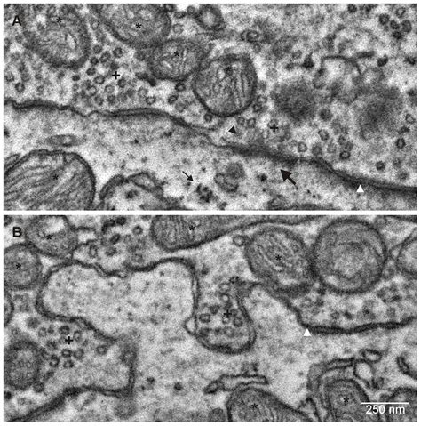 Ribosomes Microscope