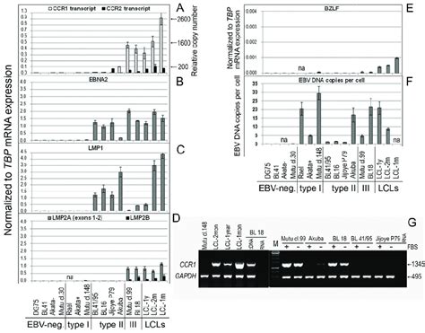 Mrna Expression Of The Ccr1 Ccr2 And Ebv Encoded Genes In Burkitt