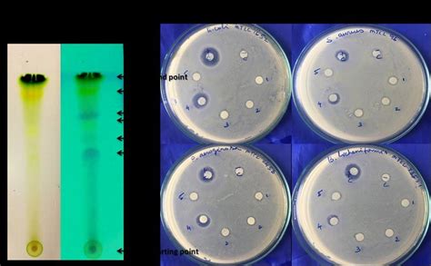 Antibacterial Activity By Tlc Bioautographic Method Fig