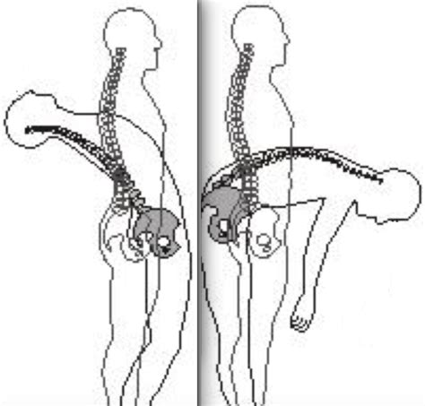 Spinal Flexion Extension | Krumur Clinic