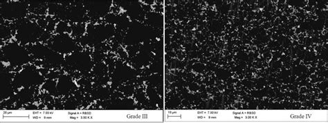 Bse Sem Micrograph Of The Grade Iii And Iv As It Is Clearly Seen Grade