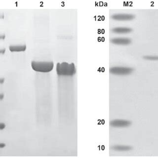 Visualization Of ScFv RBP4 Fusion Protein Purification By SDS PAGE