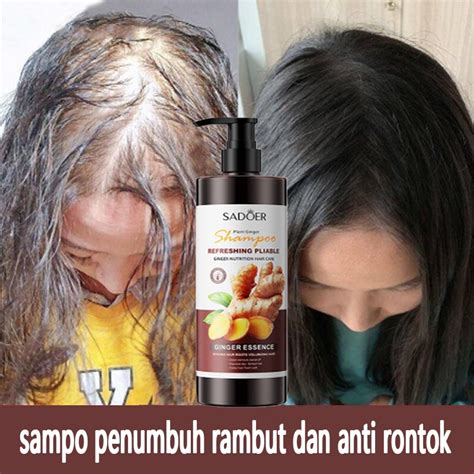 Jual Shampoo Penumbuh Rambut Mencegah Rontok Merawat Akar Rambut Dan