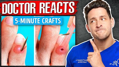 The WORST 5 Minute Crafts Health Hacks YouTube