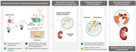 Jcm Free Full Text New Treatment Strategies For Iga Nephropathy Targeting Plasma Cells As