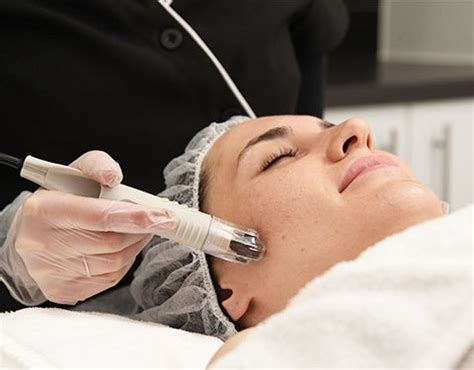 Book Microneedling Treatment In Melbourne Myskin Clinics