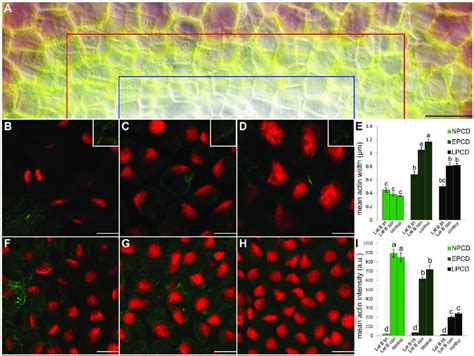 Actin Depolymerization Following Treatment With Latrunculin B Lat B