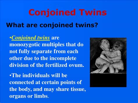 Ppt Conjoined Twins Faq Powerpoint Presentation Free Download Id