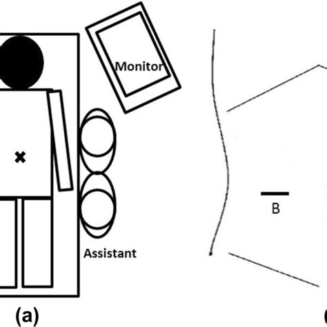 The Patients Position And Locations Of Operative Staffs And Download Scientific Diagram