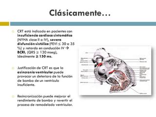 Estimulación hisiana versus biventricular en resincronización cardiaca