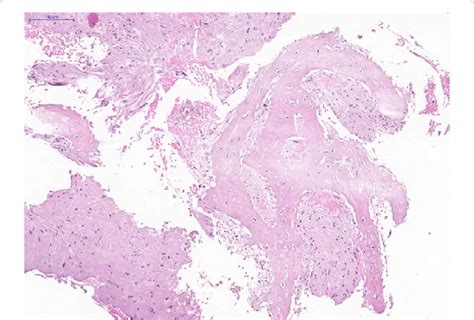 Histopathological Findings Using Hematoxylin Eosin Staining Showing