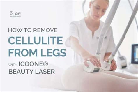 How To Remove Cellulite From Legs With Icoone®beauty Laser Pure Skin