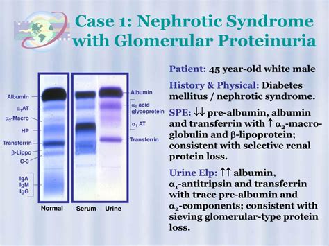 Ppt High Resolution Protein Electrophoresis Powerpoint Presentation