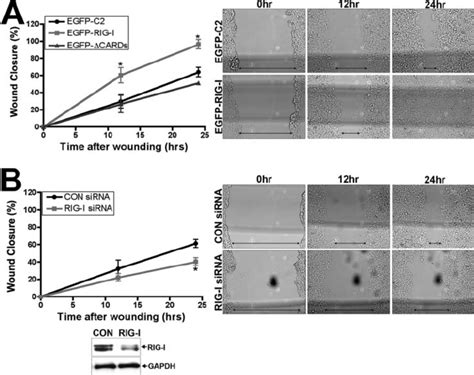 Rig I Regulates Cell Migration Wound Healing Assays Were Performed In