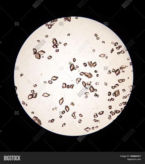 Uric Acid Urine Image And Photo Free Trial Bigstock