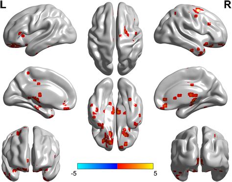 Frontiers Altered Brain Fraction Amplitude Of Low Frequency