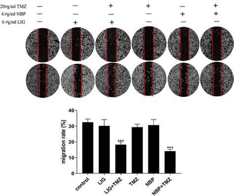 Full Article Anti Glioma Effects Of Ligustilide Or N Butylphthalide On