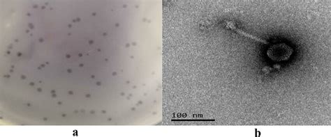 Morphology Of Phage Vb Sens Se A Plaque Assays B Transmission