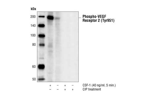 Phospho Vegf Receptor Tyr H Mouse Mab Cell Signaling