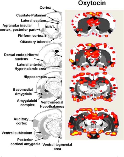 Figure 6 From Functional Magnetic Resonance Imaging Shows Oxytocin