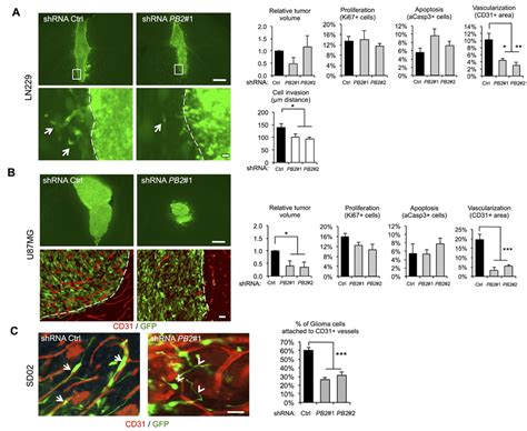 Invasive Glioma Growth Is Diminished By Plexin B2 Knockdown A B