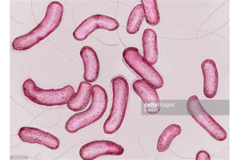 Bacterial Gastroenteritis Flashcards Quizlet