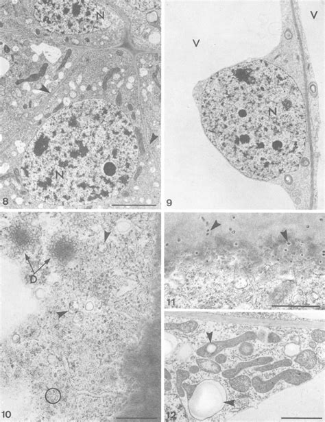 Low Power Electron Micrograpi Of Cells In The Embryonic Region Of A