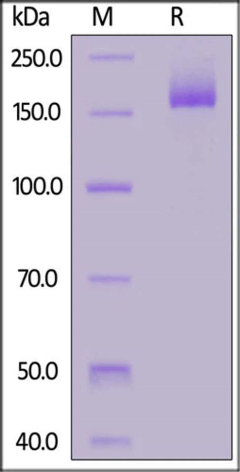 ACROBiosystems ACROBiosystems Biotinylated SARS CoV 2 Spike Trimer