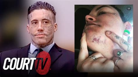 He Bit My Face Wade Wilsons Ex Girlfriend Describes Alarming Attack Youtube