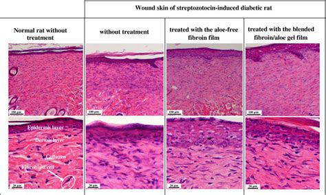 Histology Of Wounds On Day Of Treatment Stained With Hematoxylin